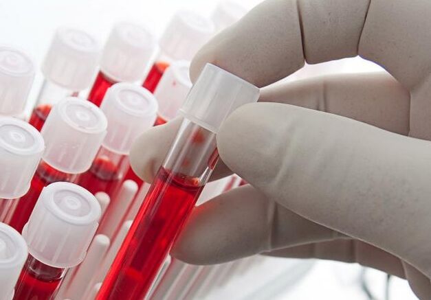 badanie krwi po spożyciu alkoholu